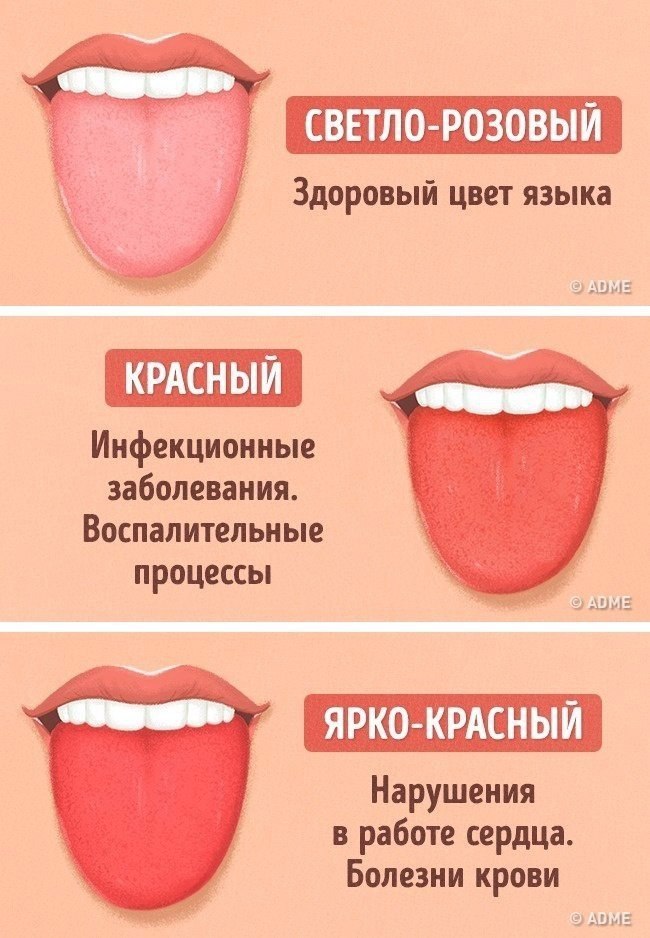 Болезни по языку схема на лету и цветам
