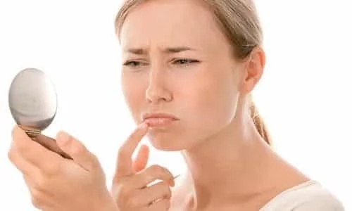 КАК ИЗБАВИТЬСЯ ОТ ГЕРПЕСА НА ГУБАХ - Всё о здоровье, №2060728779 ...