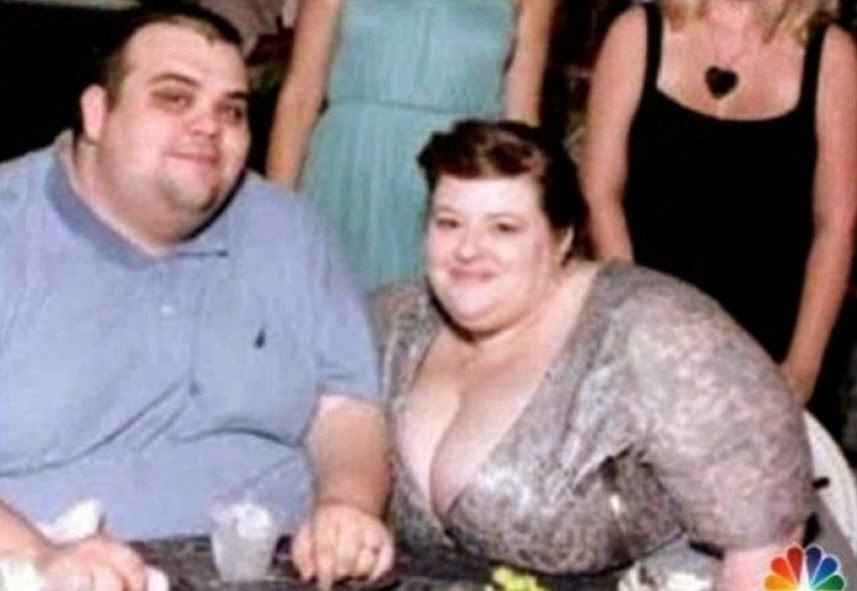 Семейное толстая жена. Парочка толстых. Пара с ожирением. Семейная пара с ожирением.
