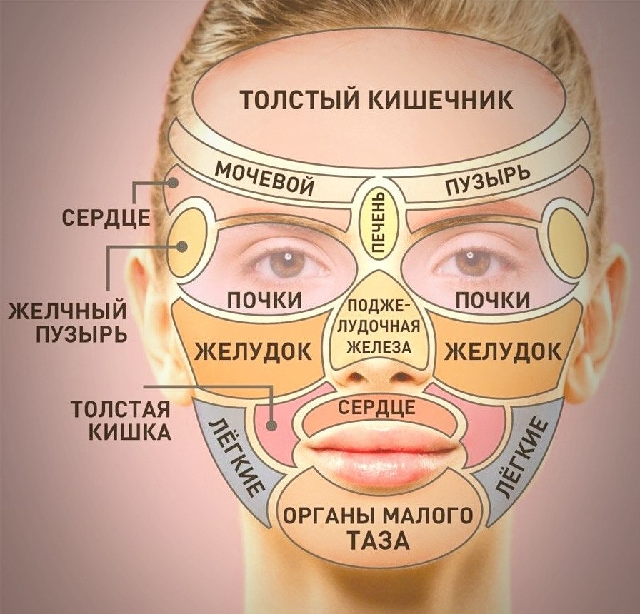 О чем говорят прыщи на лице по зонам фото
