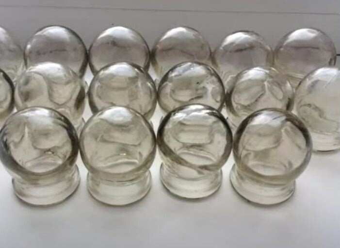 Медицинские стеклянные банки. Их использовали для ... - Назад в СССР ...