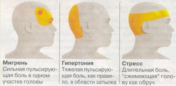  | ,  - 14  2015  12:35