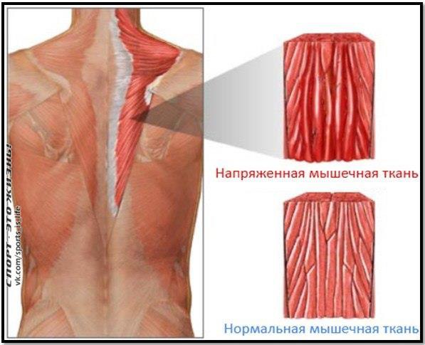 Крепатура мышц. Кто виноват и что делать? Итак, как Вы помните одним из показателей эффективно ...