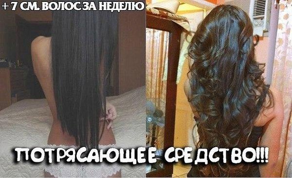 Урааааа!!!! Девочки, я нашла чудо средство для БЫСТРОГО роста волос!!!! Я о нём мечтала все свои 20 ...