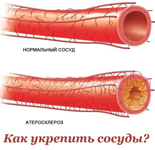 Как укрепить сосуды? Ослабление, истощение сосудов приводит к нарушению кровообращения и обмена ...