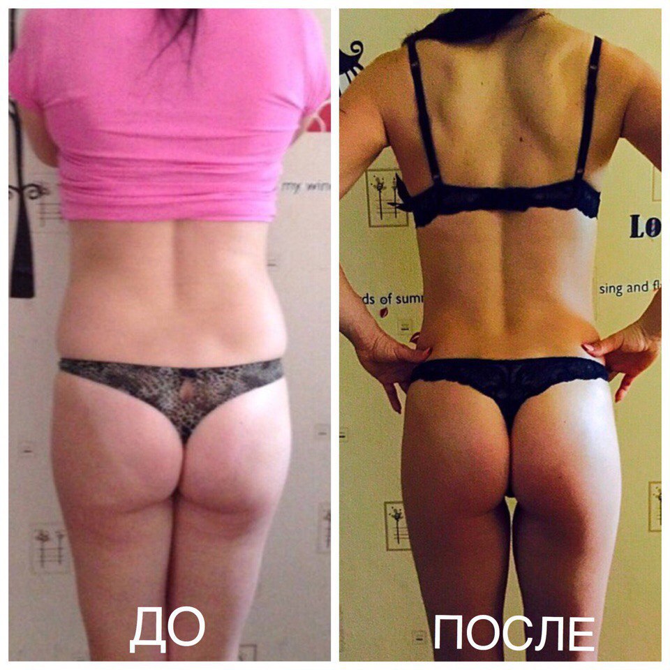       ViaFit 