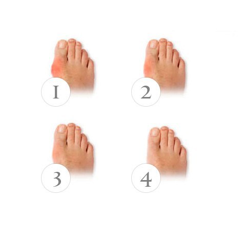 Valgus Pr - ee cpeco o ae oco!       ... - 9