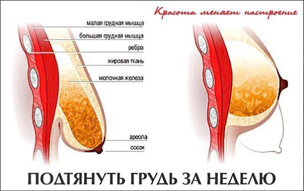 Я всегда гордилась своей аккуратной грудью. Персики - как любовно называл их мой муж. Потом ...