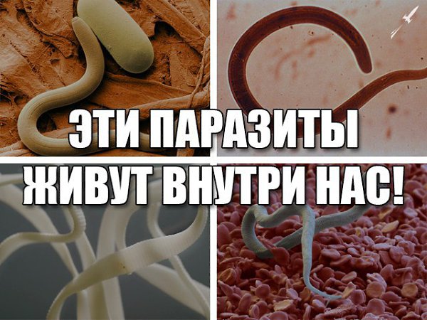 Мужики, хочу сказать, я просто в шоке. Ну, реально, никогда не думал, что со мной может случиться ...