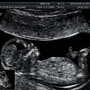 ���� ��������, ���������, 49 ��� - ��������� 20 ��� 2016 � ������ ������ ��������