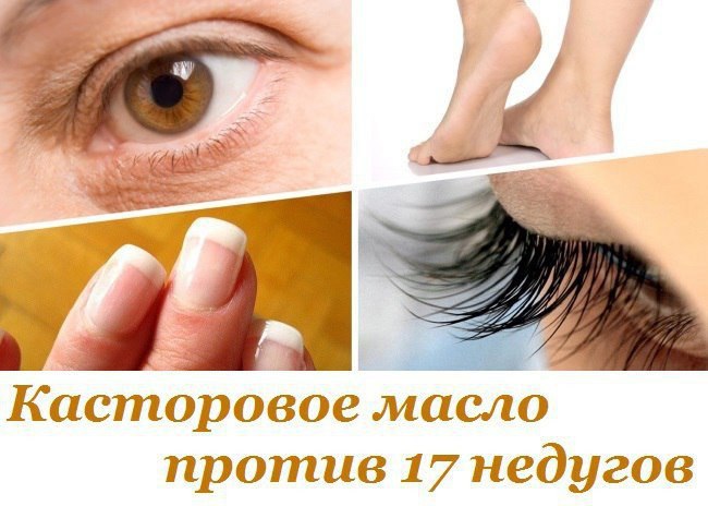 Касторовое масло против 17 недугов. Это больше, чем просто косметологическое средство! Хотя ...