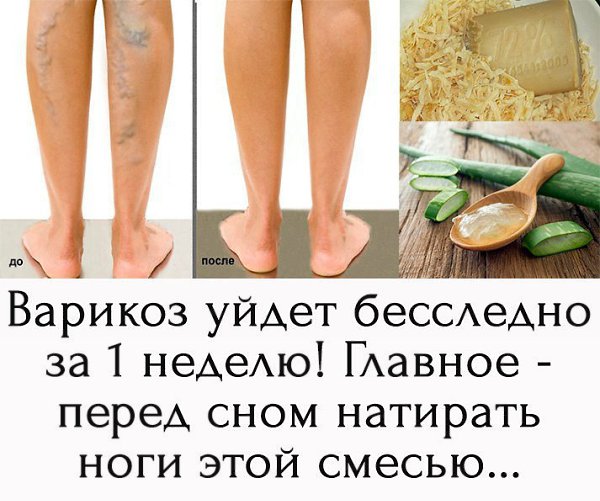 Натри им вены перед сном и ТРОМБЫ УЙДУТ! Сильнейшее средство от ВАРИКОЗА, записывай рецепт... ...