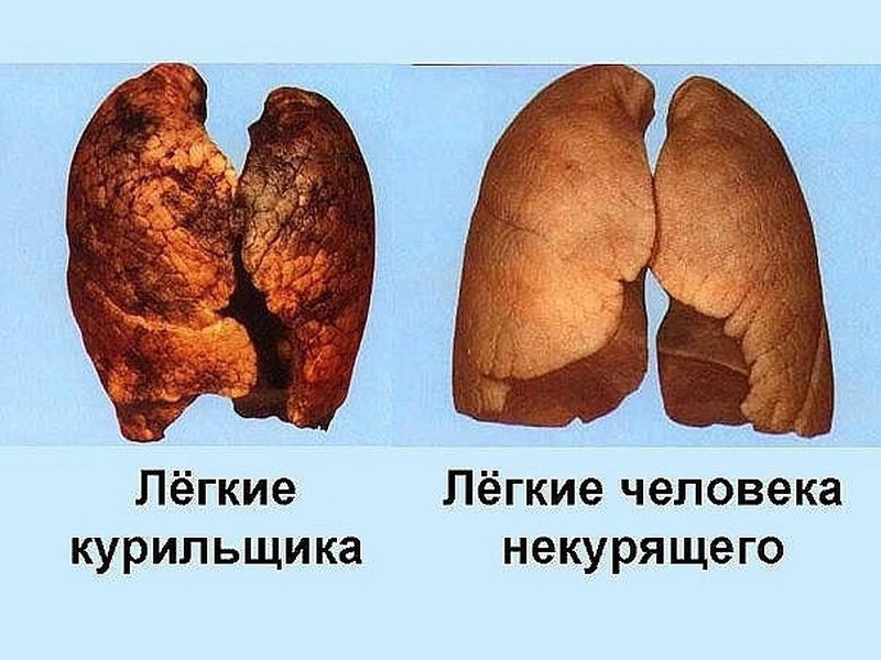 НАРОДНЫЙ РЕЦЕПТ ДЛЯ ОЧИЩЕНИЯ ЛЕГКИХ КУРИЛЬЩИКА. Для того чтобы приготовить этот очищающий лёгкие ...