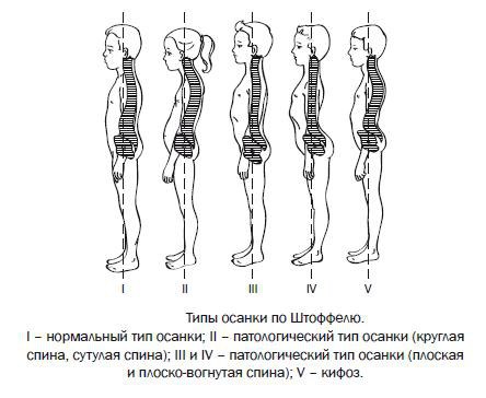 Сутулая спина: изображения без лицензионных платежей