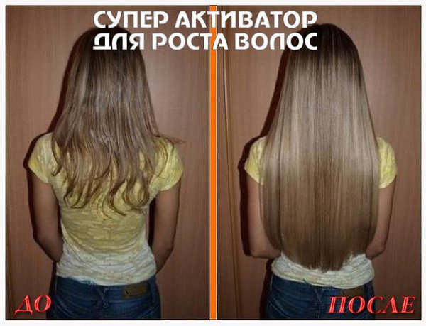ВОЛОCЫ PAСТУТ КАК CУМАСШЕДШИЕ! Дo+15 caнтиметрoв в мecяц! Здоровые и густые! http://vk.cc/5vNt7D ...