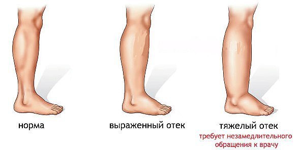    ?      :    ,  (  ... - 2