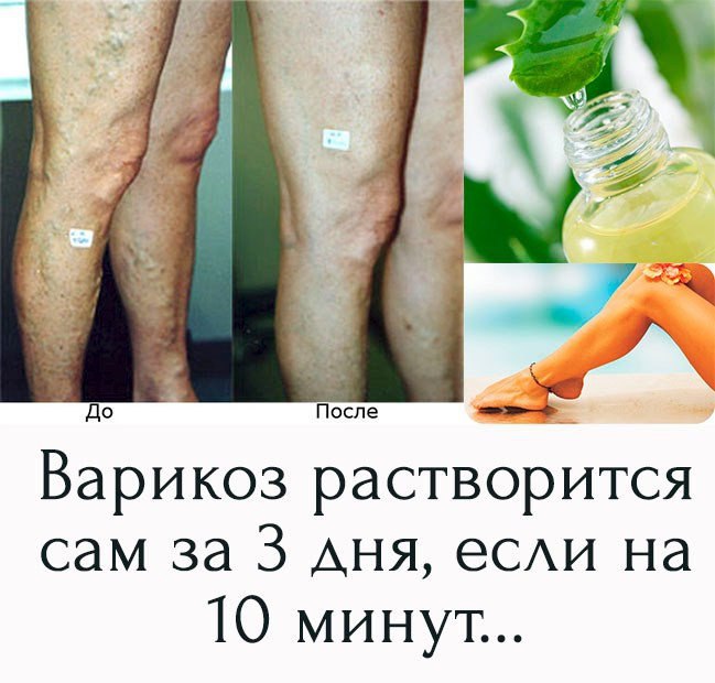   !!!     .. https://fotostrana.ru/away?to=/sl/DoA3