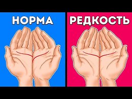 «Прочтите» Свои Ладони и Узнайте о Себе Много Нового.-------------------------------------------------------------------- --------------------Руки человека могут рассказать о том, какой он в любви. О...