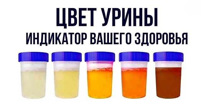 Цвет урины – индикатор вашего здоровья. Знаете ли вы? Хотя многие люди не знают об этом, моча может ...
