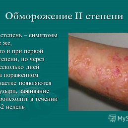 �������, ������, 46 ���