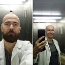 До и После)))