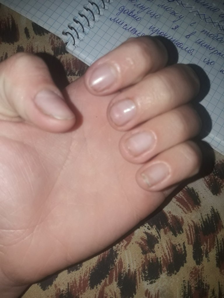 #истории@modnailru.Ребят у меня на данный момент ужасные ногти,после последнего маникюра. Я не знаю ...