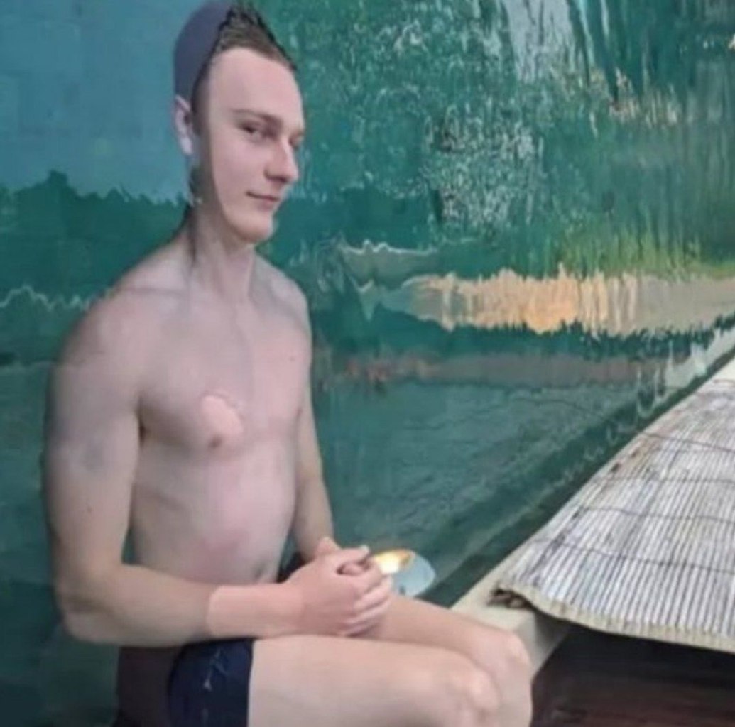   ,  - 2
