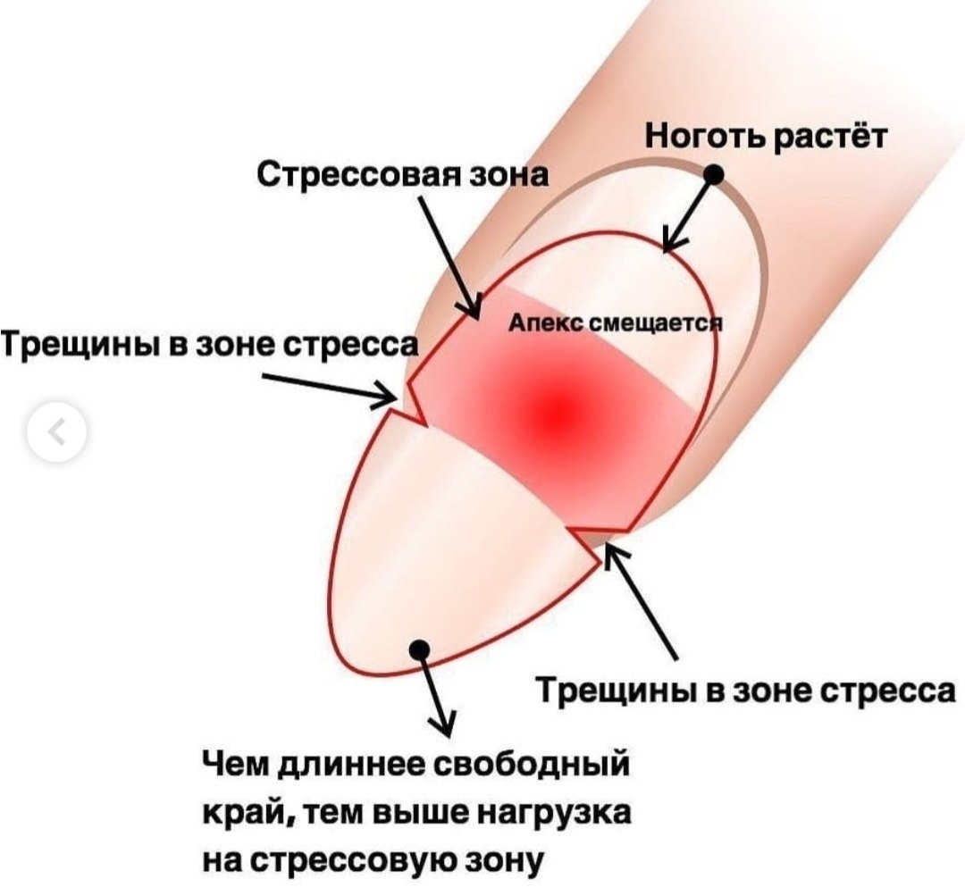 Выравнивание ногтевой пластины схема