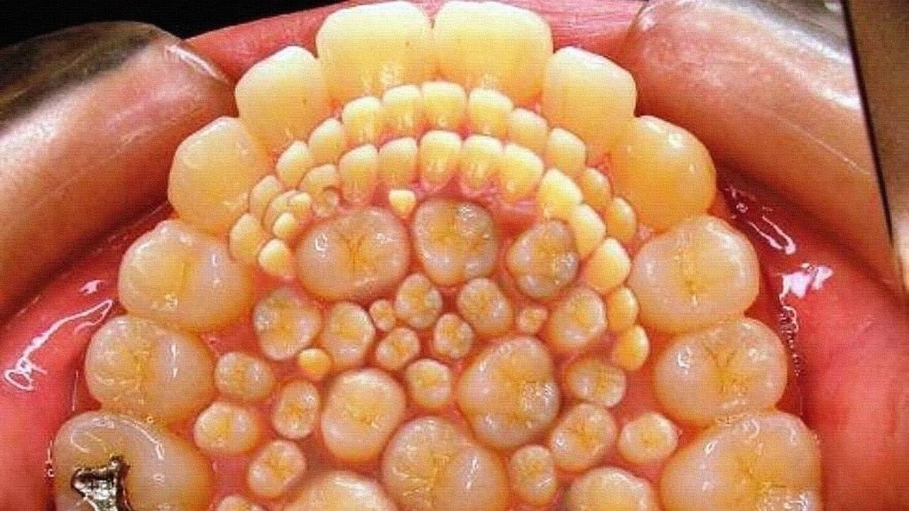 -tooth |tu| .He cut a tooth.   . ,   )) - 3