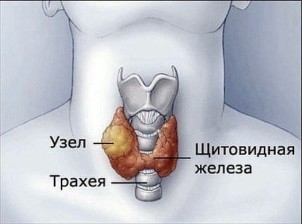 ЛЕЧИМ УЗЕЛ НА ЩИТОВИДНОЙ ЖЕЛЕЗЕ.Смешайте по одному стакану молотой гречневой крупы, пропущенных ...