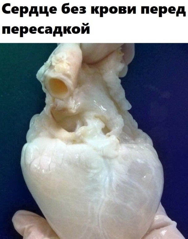 BEST | , ,  - 16  2020  19:55