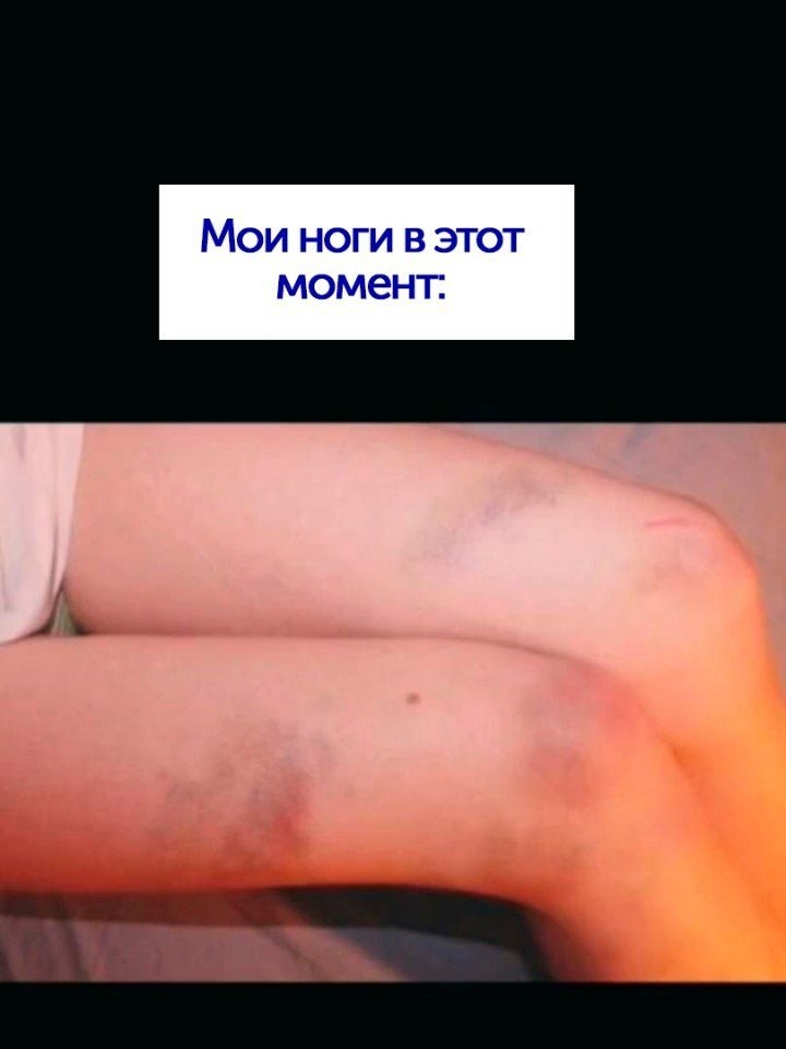       - 2