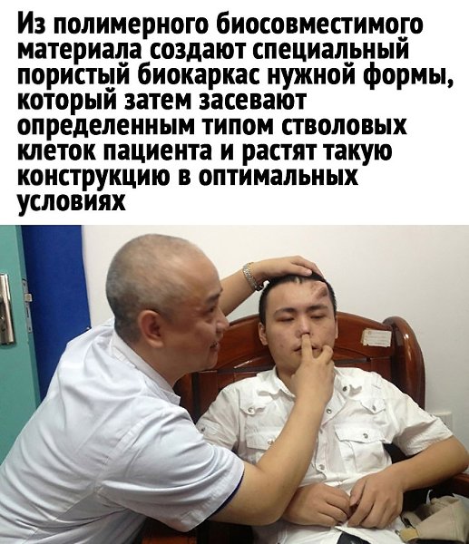     ! - 2