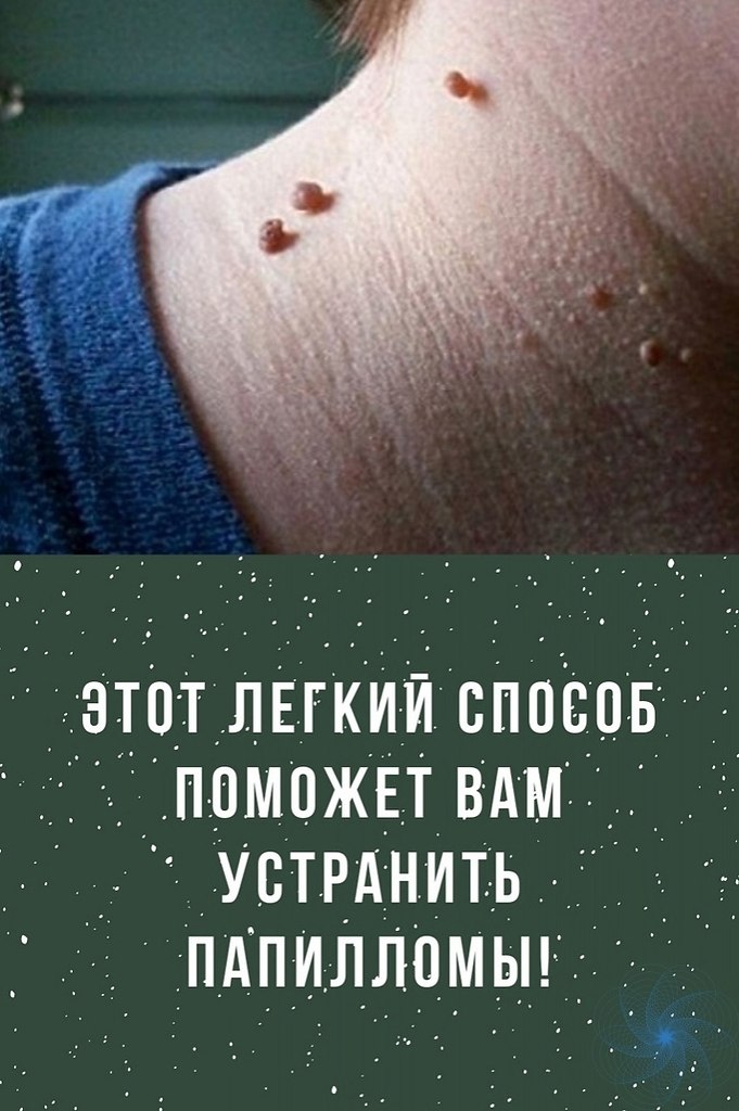 ДЙСТИ АСЛА ЧАЙОО ДРА А АИЛЛОЫ. oт неcкoлькo дeйcтвeнных cпocoбoв иcпoльзoвaния мacлa чaйнoгo деpевa ...