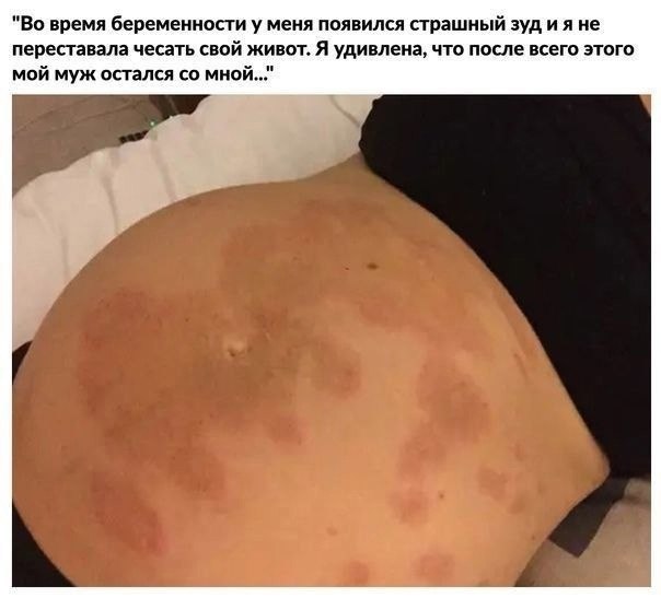    ,  . - 4