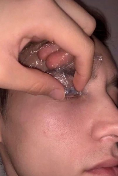 ,      - 3