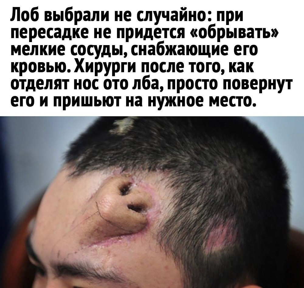     ! - 3