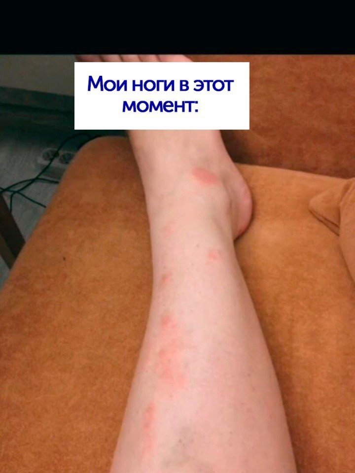       - 4