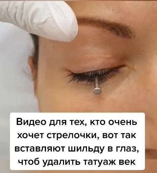         - 3