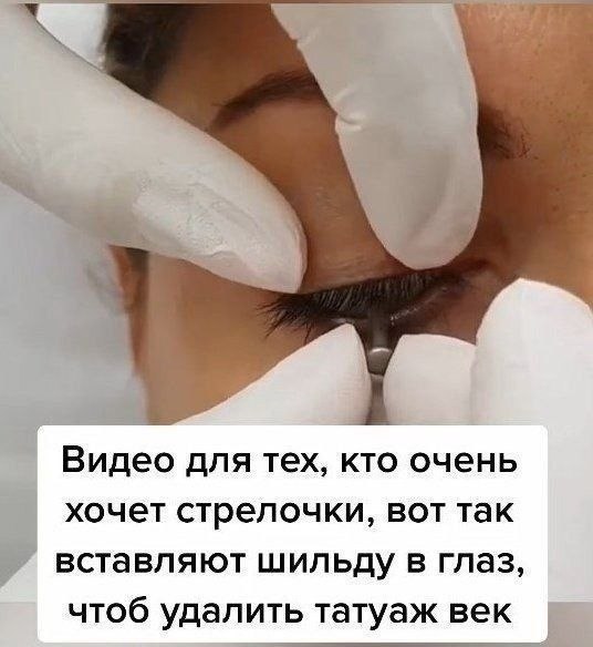         - 2
