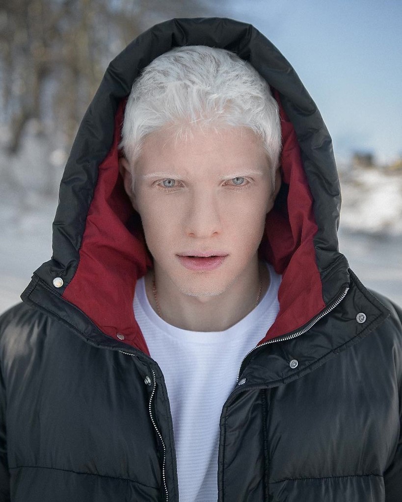    - 5