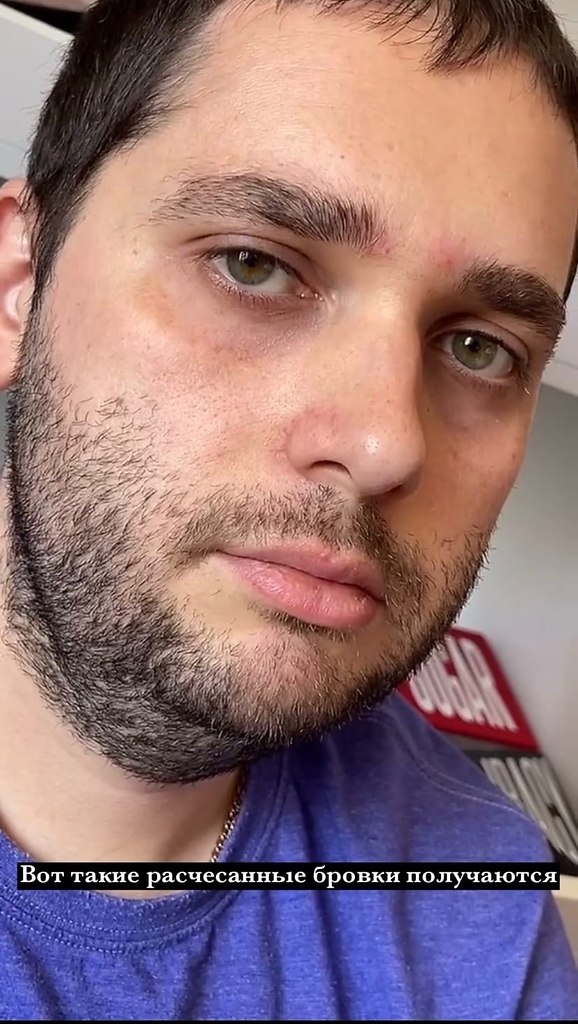 Koa  e e poe, o o ec  oeo a)) - 5