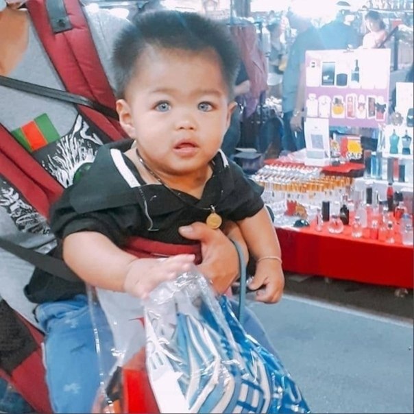 Малыш из Таиланда стал звездой благодаря своей необычной внешности. - 2