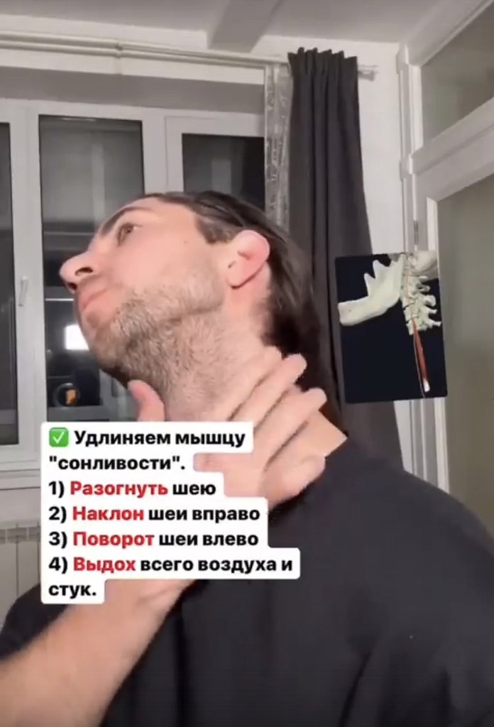       ? - 2