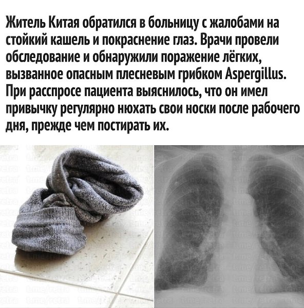   . - 2