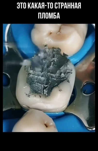        - 2