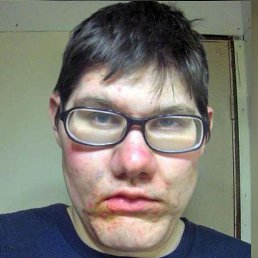 , 44, --