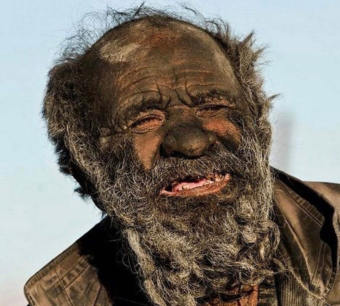Не мылся всю жизнь. Аму хаджи, который не мылся 60 лет. аму хаджи человек который не мылся.