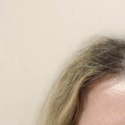 ��������, 35 ���, ������