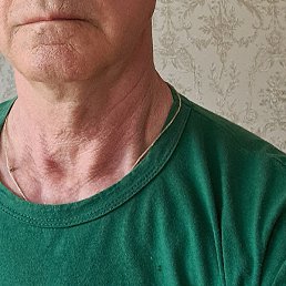 ����������, �����-���������, 71 ���